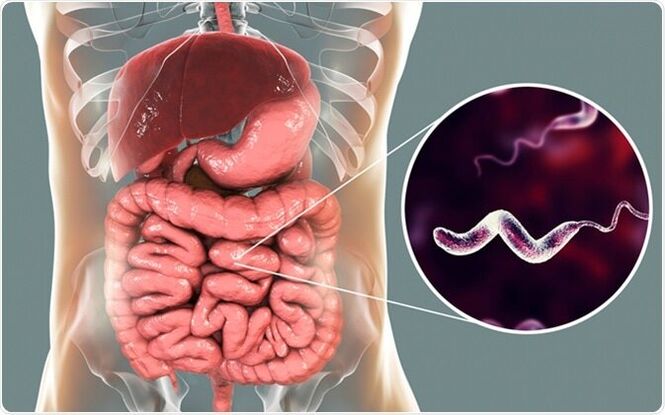 ¡Los parásitos liberan toxinas en el cuerpo y el medicamento Vermixin le ayudará a deshacerse de ellos! 